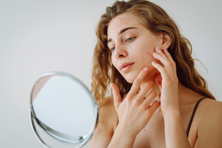 Close-up of a cute woman with problem skin looking in the mirror. Dermatology concept, allergy.